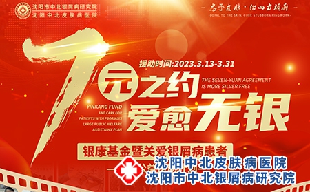 3月13-31日关爱银屑病[7元之约-爱愈无银]大型公益援助计划