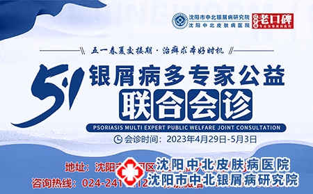 2023年4月29日-5月3日五一银屑病多专家公益联合会诊在沈阳中北银屑病研究院举行
