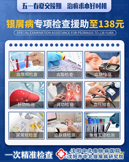 沈阳中北银屑病研究院银屑病专项援助检查仅需138元
