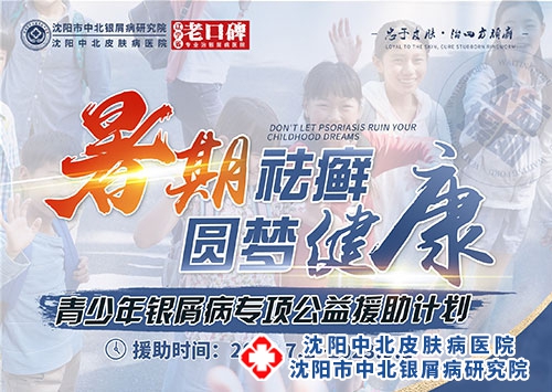 青少年暑期银屑病专项公益援助计划7月2日-9月1日沈阳中北医院举办