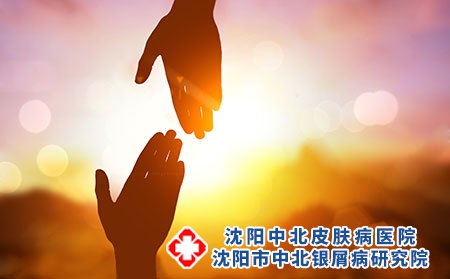牛皮癣患者日常注意事项有哪些?诱发因素有哪些?