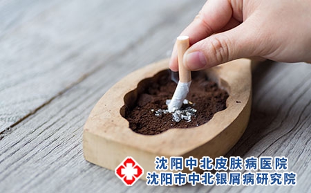 烟草威胁环境，吸烟有害健康-沈阳中北牛皮癣医院戒烟很重要