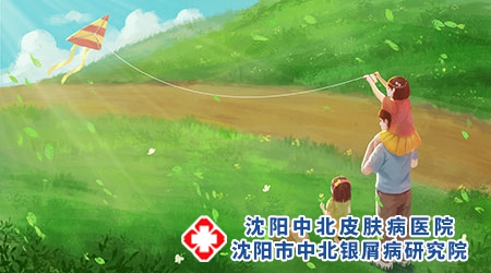 六一儿童节-沈阳中北银屑病医院儿童银屑病患者要注意心理健康