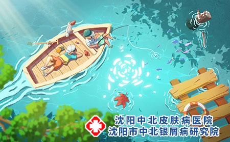 沈阳中北牛皮癣医院端午小长假牛皮癣患者夏季养生指南