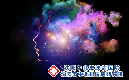 得了银屑病怎么办?如何预防复发?