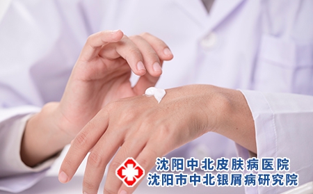 牛皮癣患者秋季如何护理?防治措施有哪些?