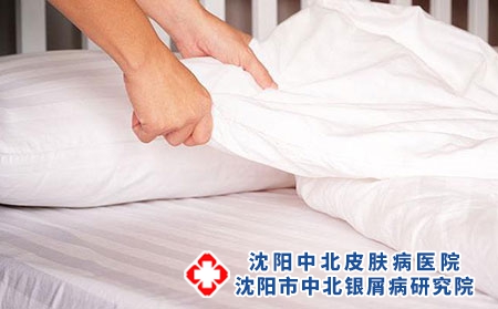 牛皮癣的病因_沈阳牛皮癣医院地址