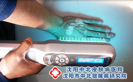 红皮银屑病护理诊断
