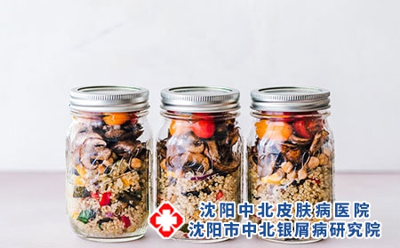 得了牛皮癣怎么办呢?沈阳皇姑区治疗牛皮癣好的医院是哪家