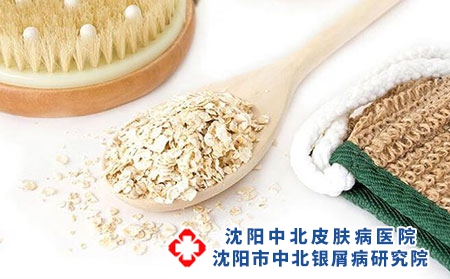 沈阳看银屑病哪个医院口碑好-沈阳牛皮癣医院哪家治疗的好
