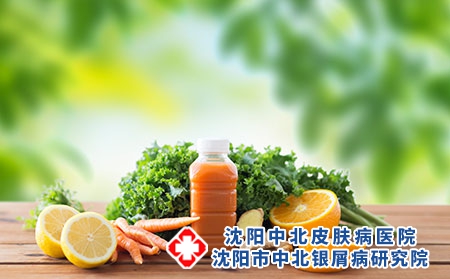 导致牛皮癣出现的原因都有哪些