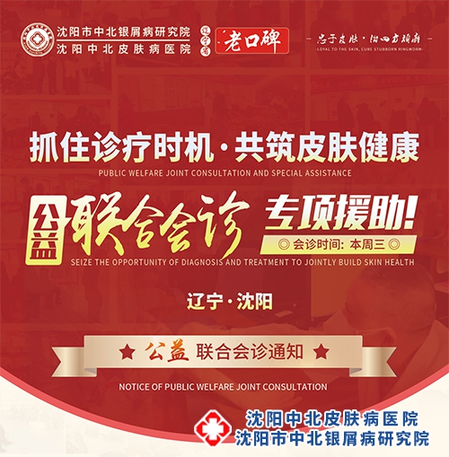 牛皮癣公益联合会诊专项援助活动4月19日沈阳牛皮癣医院举行