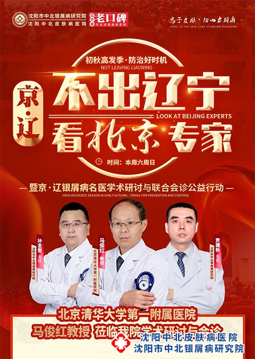 [不出辽宁看北京专家]沈阳牛皮癣医院本周末举办京辽牛皮癣名医公益会诊