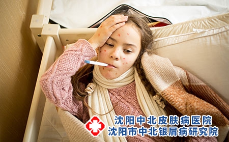 摄图网_304086247_躺在床上和测量温度的天花患病女孩肖像（企业商用）