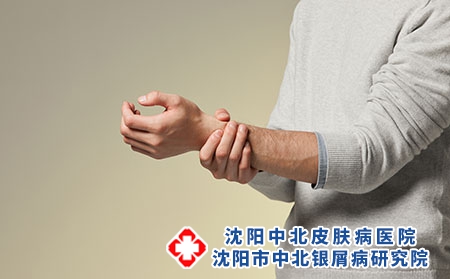 摄图网_501528683_青年男性手腕疼痛（企业商用）关节