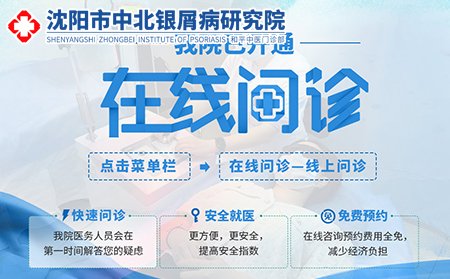 沈阳中北皮肤病医院在线问诊