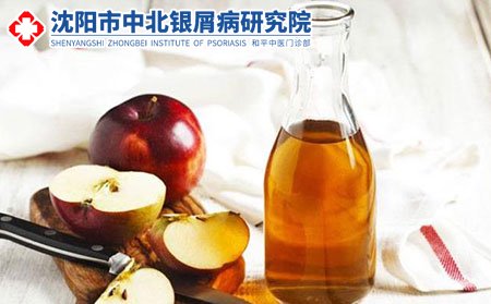 在这躁动不安的秋季，应如何与牛皮癣保持距离?