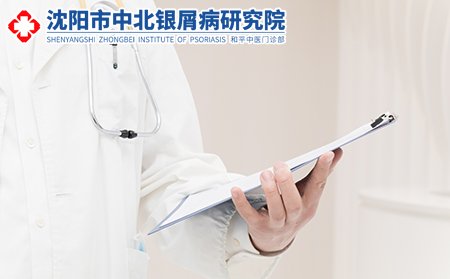 沈阳中北银屑病研究医院可靠吗
