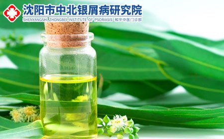 沈阳专业治疗银屑病医院