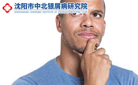 沈阳中北银屑病研究院看病多少钱