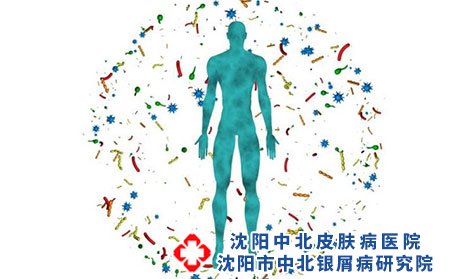 沈阳中北银屑病研究院好不好