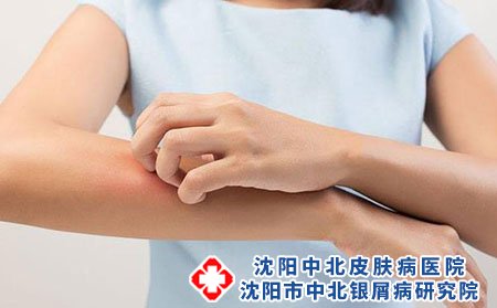 沈阳中北医院贵吗