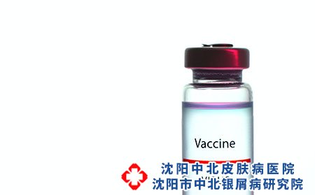寻常性银屑病的不同症状表现