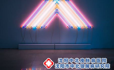 得了银屑病的护理事项有哪些