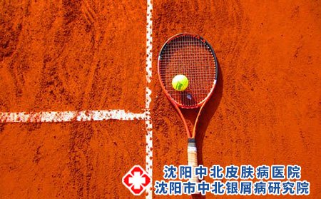 什么中药能治银屑病?