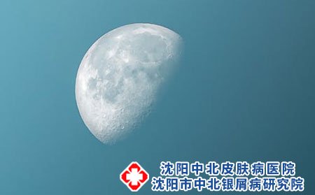 银屑病患者如何提高免疫力?