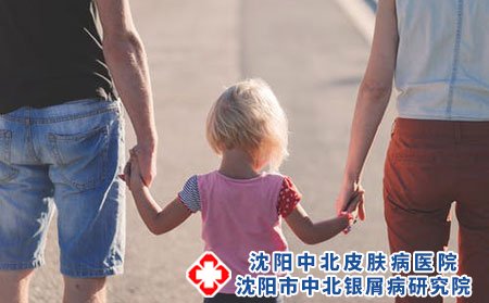 红皮型银屑病有哪些症状?