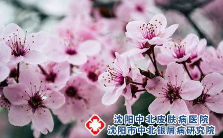 男性患银屑病的特点，银屑病发病原因和遗传有关吗