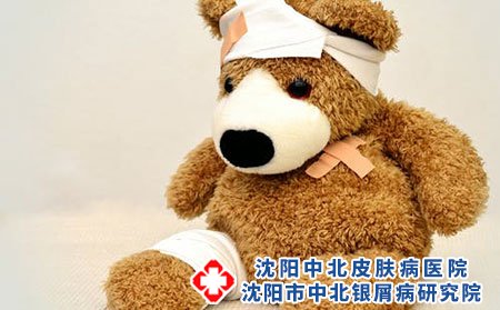 患有银屑病可以化妆吗?