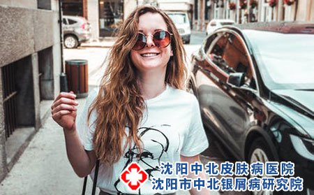 患有银屑病可以怀孕吗?