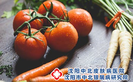 咽炎也可诱发银屑病吗