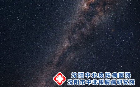 银屑病能完全治好吗沈阳中北银屑病医院讲解
