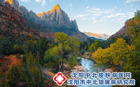 面对银屑病沈阳中北医生讲避免癣上加伤