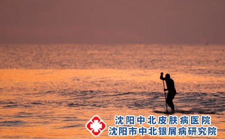银屑病俗称牛皮癣，能够治愈吗?