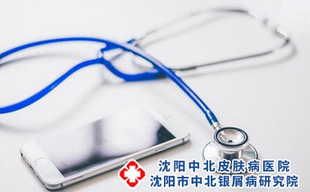 银屑病俗称牛皮癣，能够治愈吗?