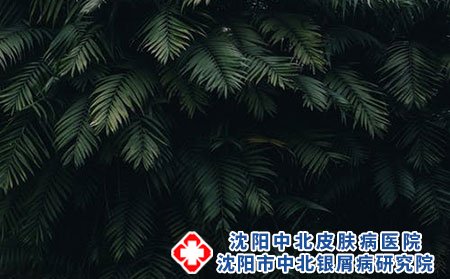 虽说冬季银屑病魔更猖狂-把握好这些有利条件定能打败它