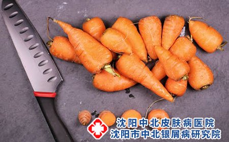 银屑病为何偏偏在冬季加重