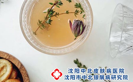 沈阳中北银屑病医院告诉你如果患有银屑病该怎么办?